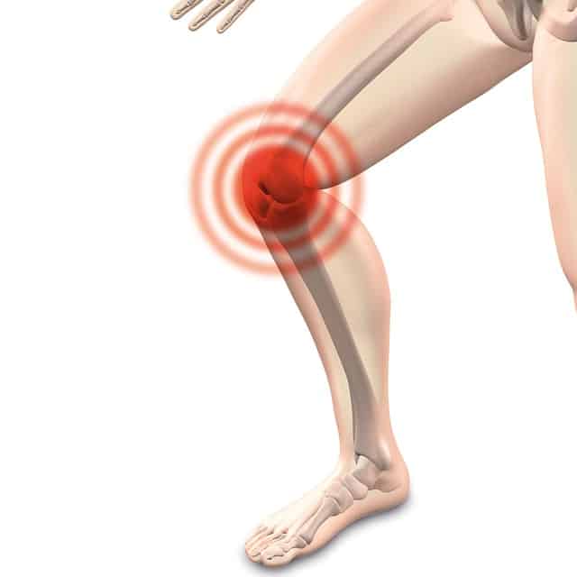 Sindrome della bandelletta ileotibiale: cos’è e come si cura il ginocchio del corridore?