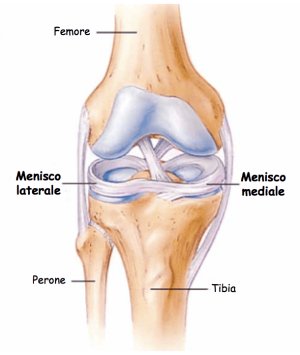 dolore menisco