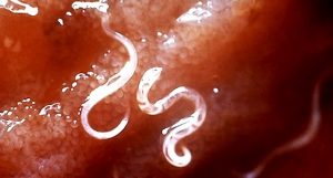 parassiti intestinali